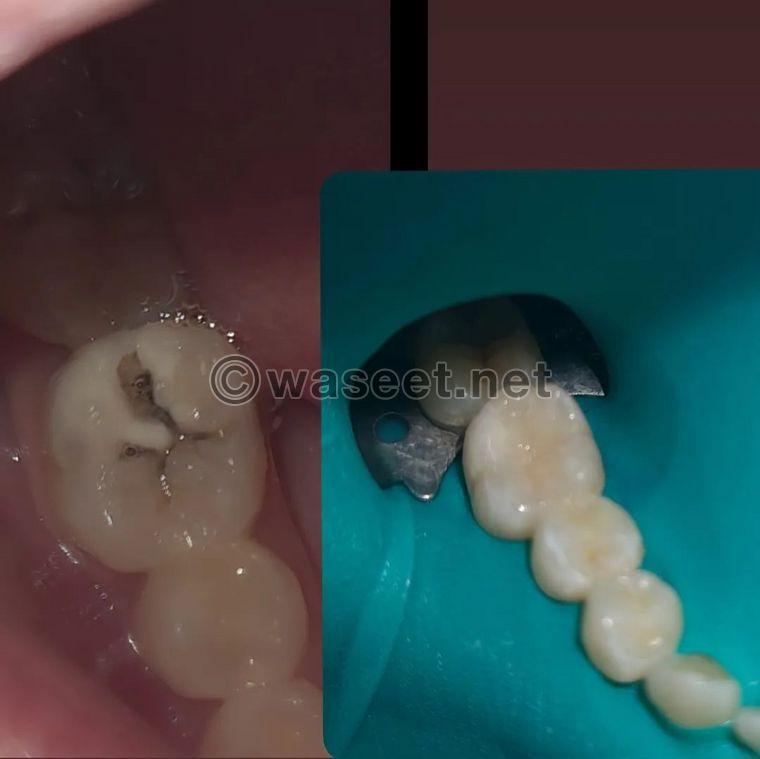 دكتور عبد المجيد التركي  طبيب اسنان 0